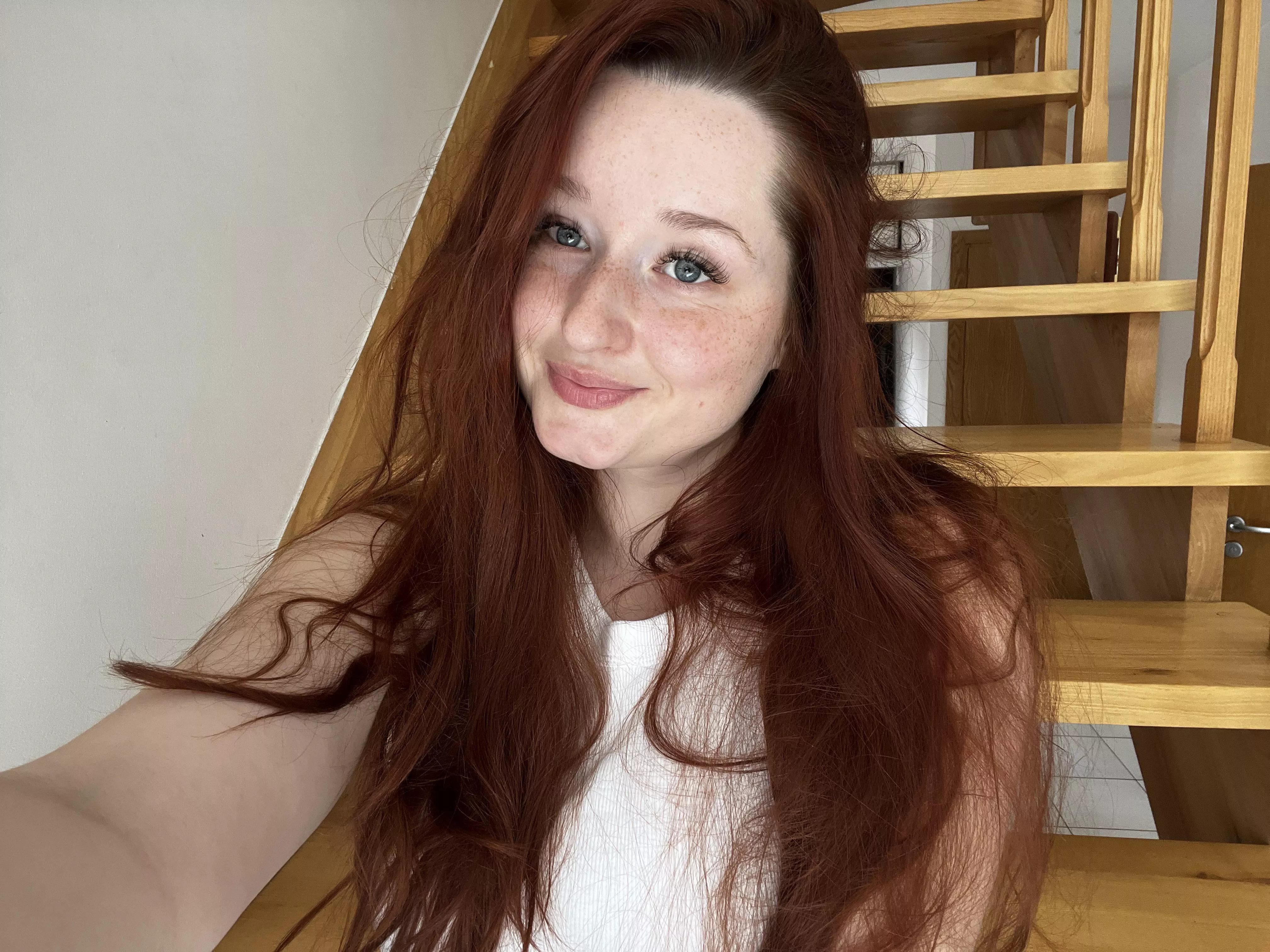 I love my freckles and I hope you like them too! [irtr]