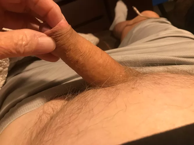 What do you think about my foreskin