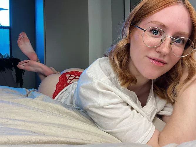 I love my freckles and I hope you like them too! [irtr]