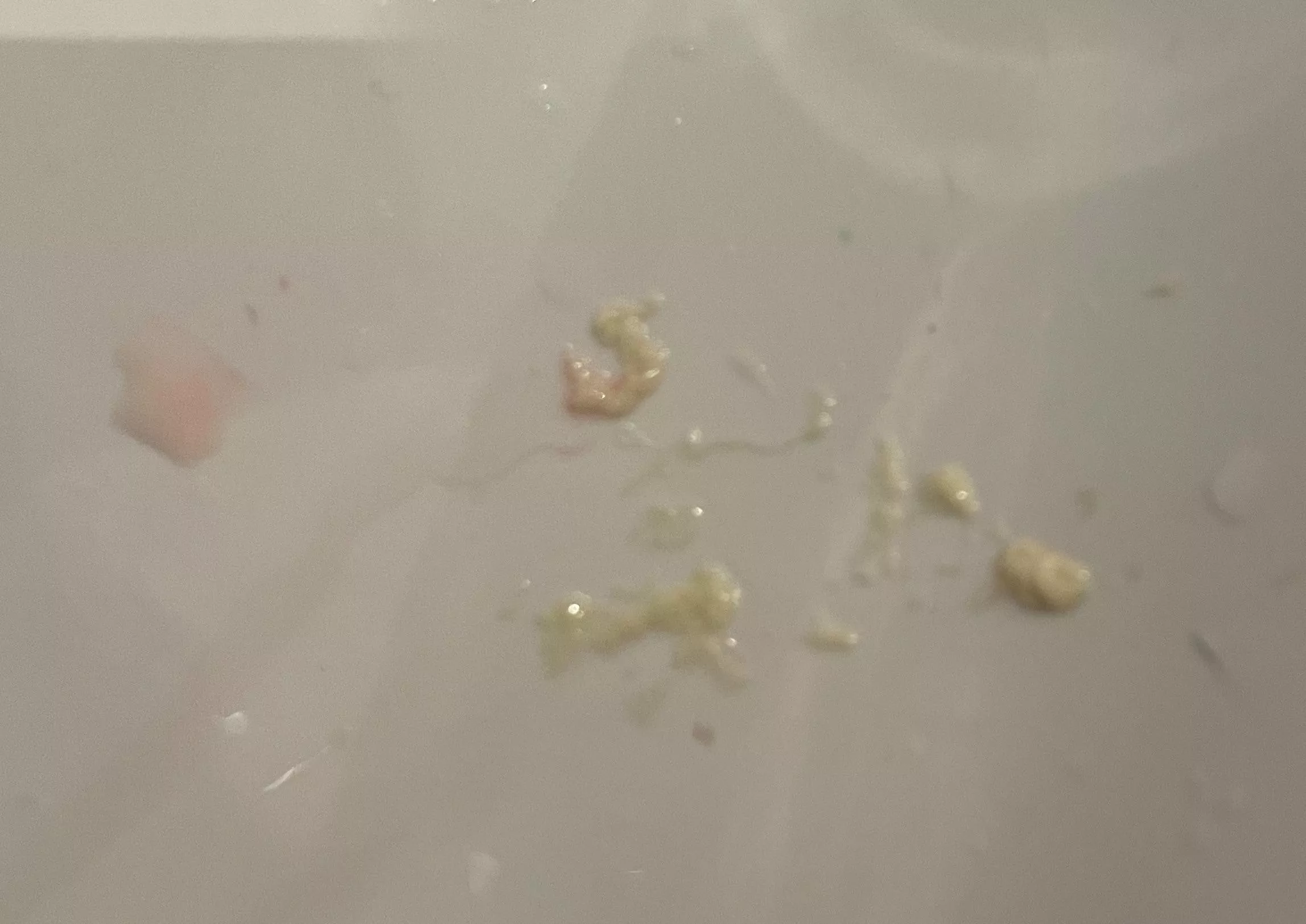 Popped a milk bleb on my nipple and unclogged a milk duct that had given me mastitis (being treated). Felt so much better after the thick milk came out!