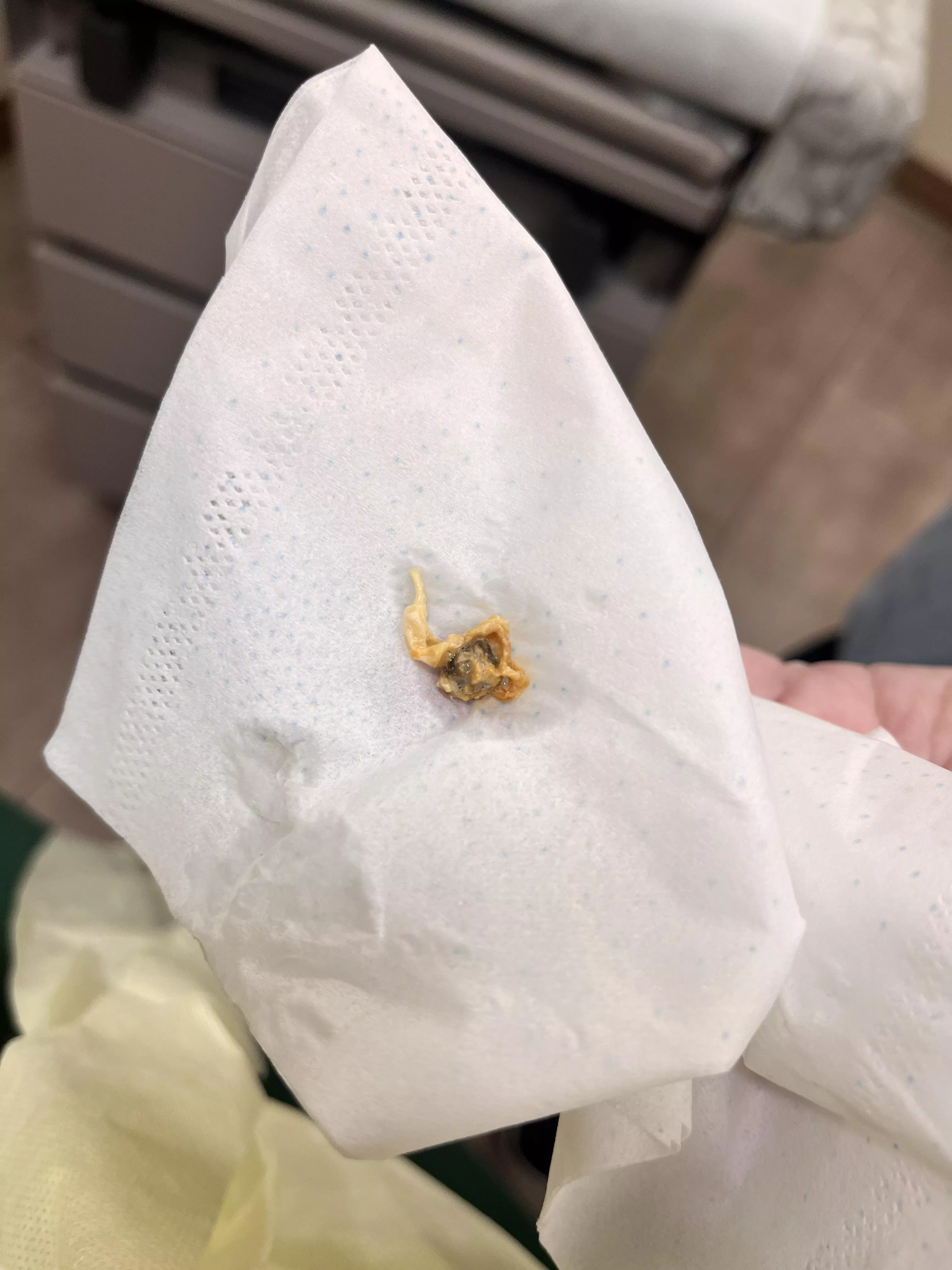 went to dr for ear infection - couldn’t see ear drum because it was blocked by this beast