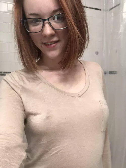 Time to go on a freckle hunt