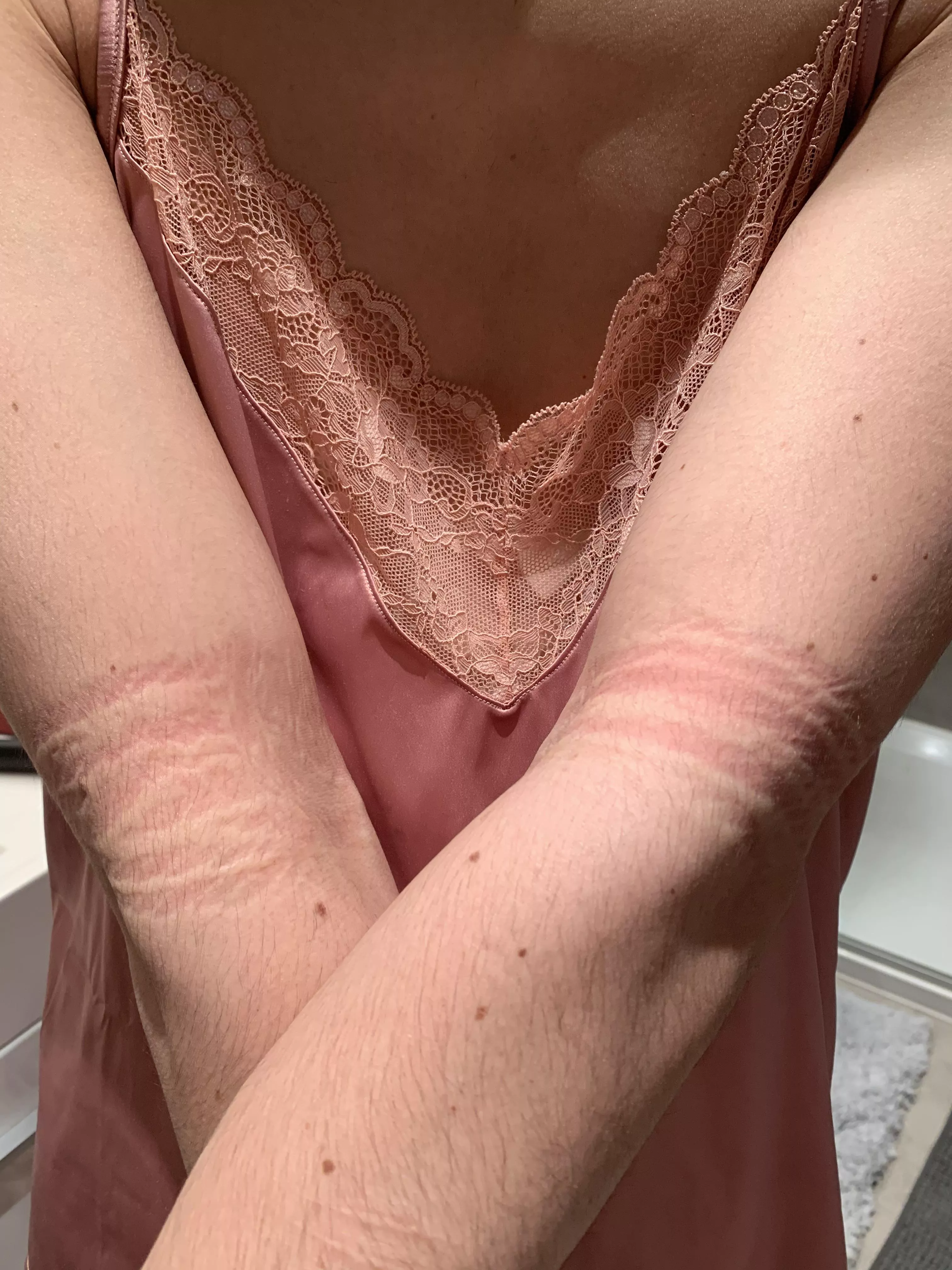 Would you want these marks 24/7? I would ^^