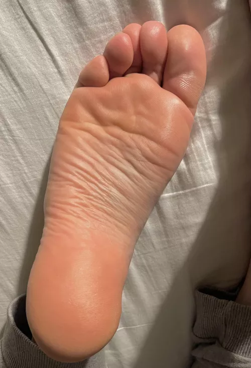 Wrinkles