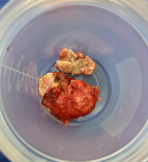 Forbidden Pop removed