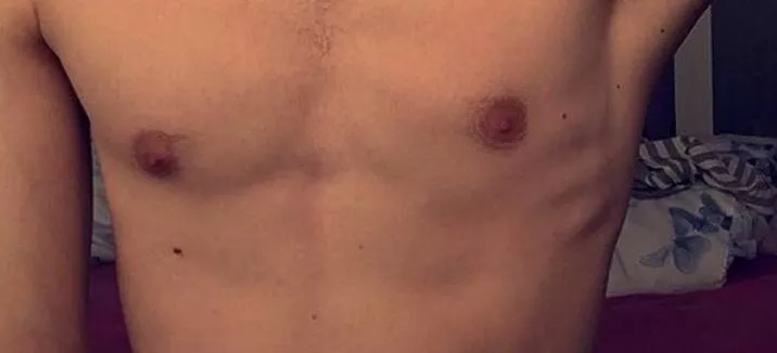 Whos got a nipple fetish ? 