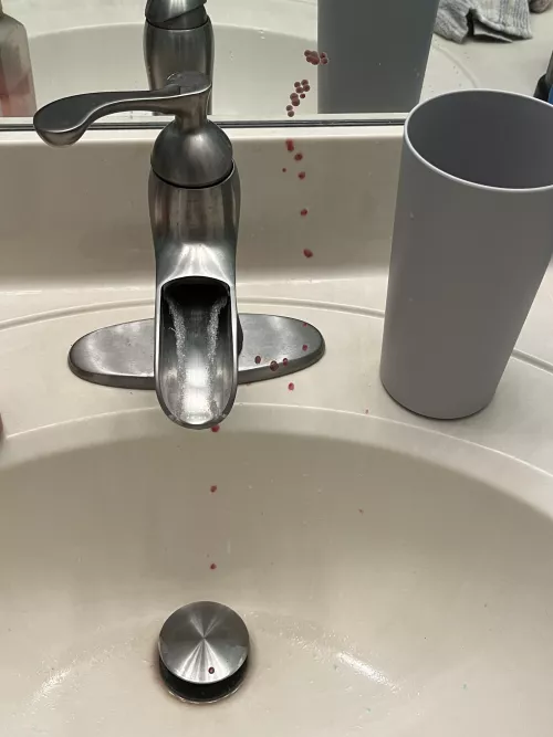 i popped a really deep cyst/abscess on my biking line and it exploded