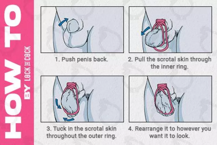 Fufu clip installation