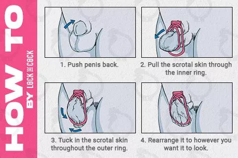 Fufu clip installation