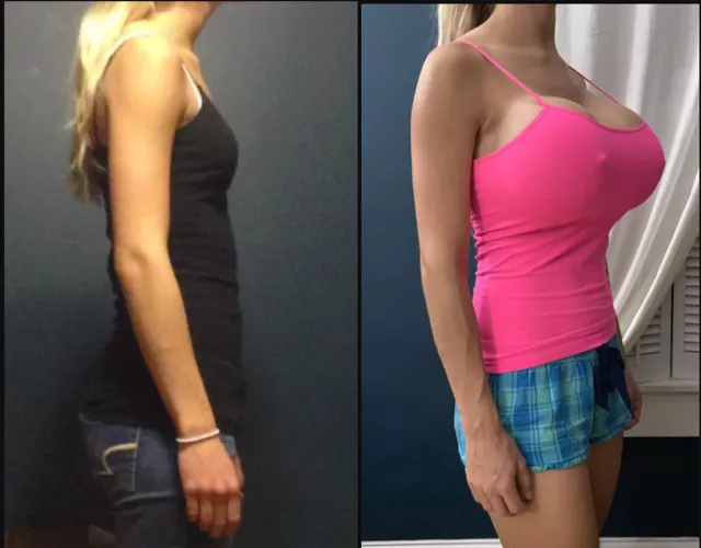 Katelyn Keplar's progression 