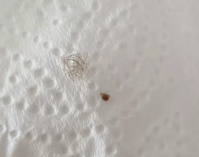 Medication made me come out in spots. Missus decided to pop some old ones whilst she was at it and this came out