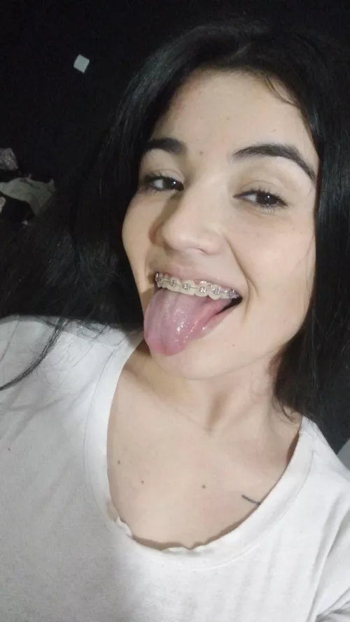 What do you think of my pink braces?