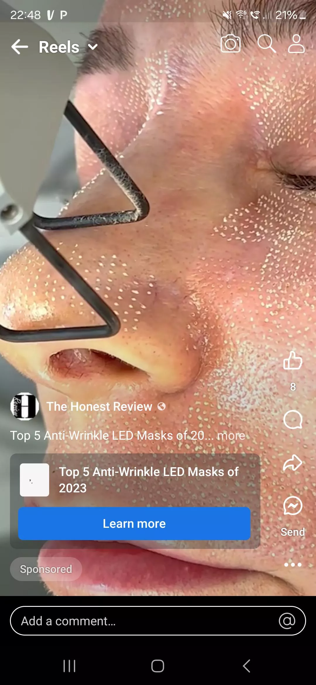 What is going on here? Is it a tool? Are those white heads? 