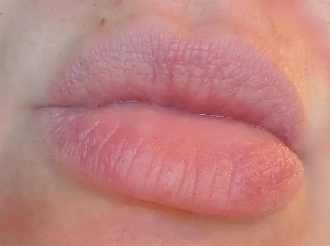 Naturally plump and pouty