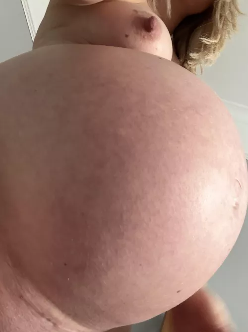 My bump looks like a big balloon