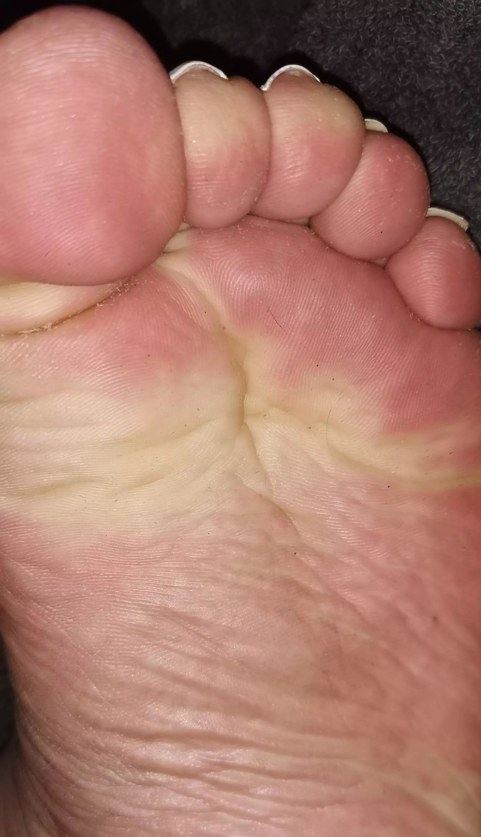 Do you like my wrinkles? 😁