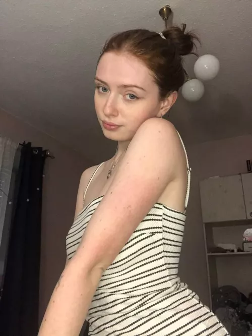 [IRTR] There will be even more freckles in summer