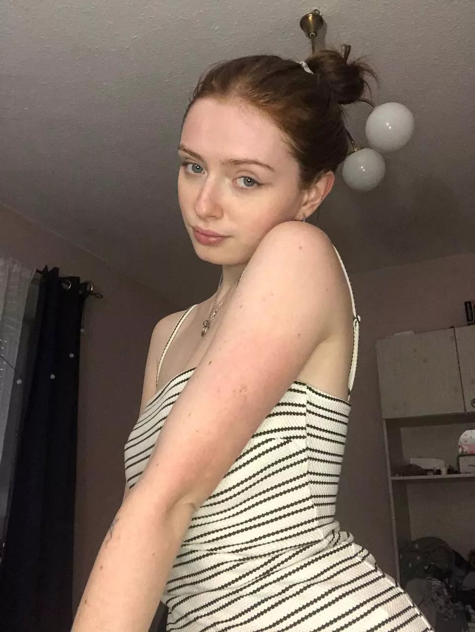 [IRTR] There will be even more freckles in summer