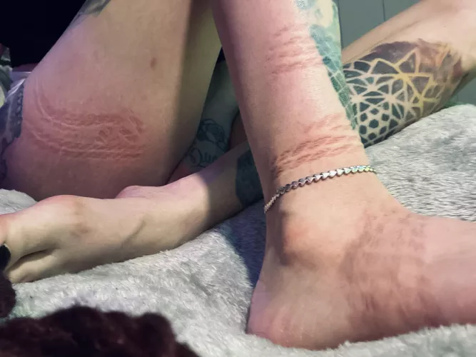 Something about those rope marks 🥰