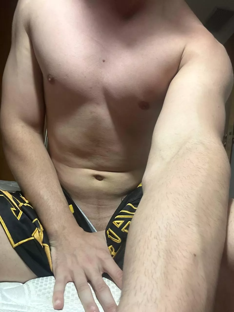 Veins not this visible is still valid?