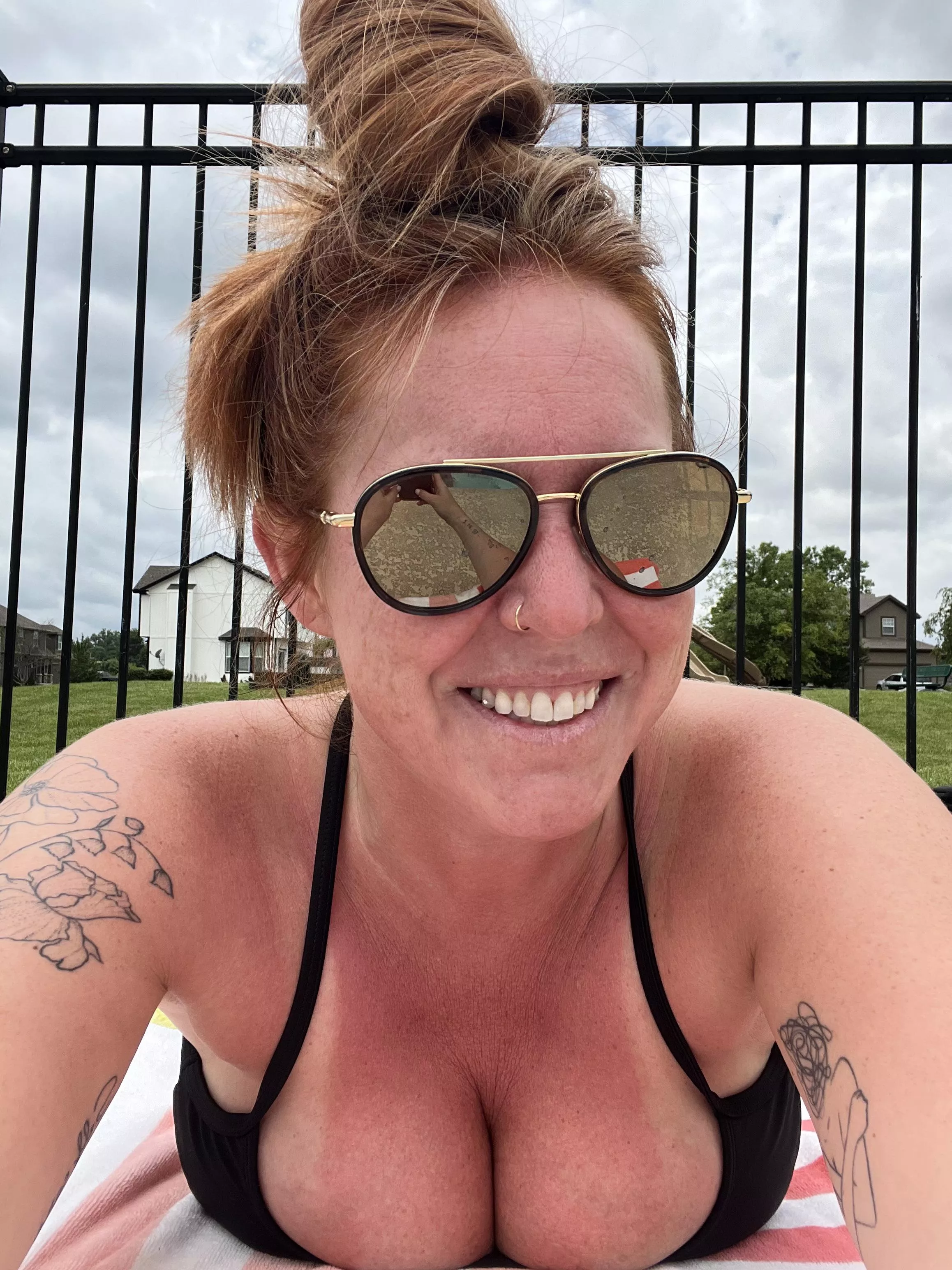 Can you spot the freckles? [IRTR]