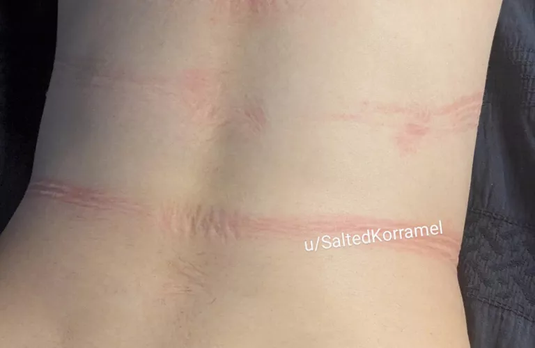 Some of the rope marks on my back 🖤 