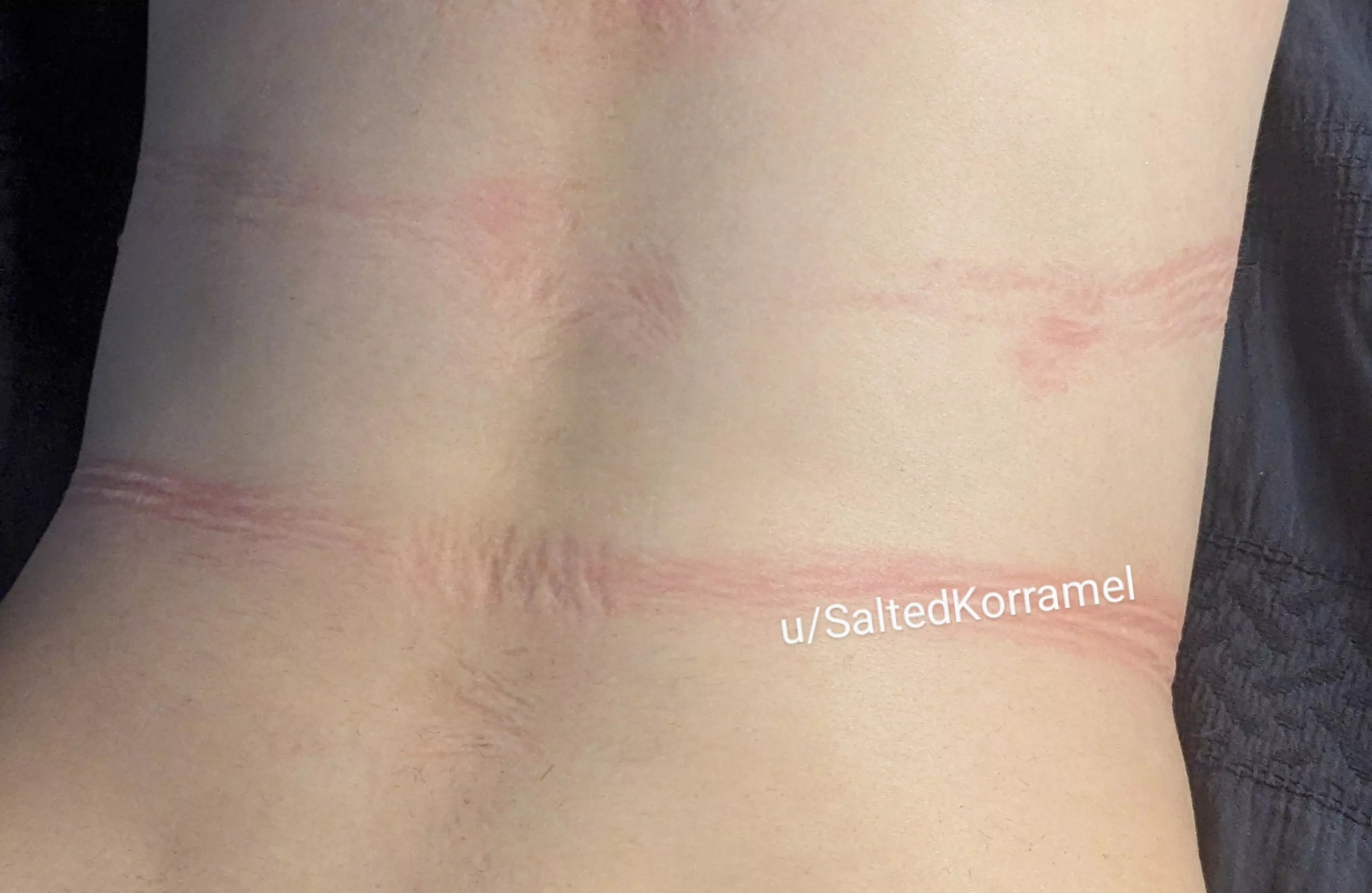 Some of the rope marks on my back 🖤 