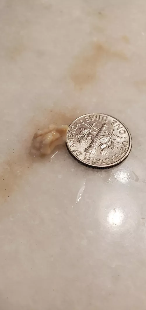 Tonsil stone I cleared this morning. 