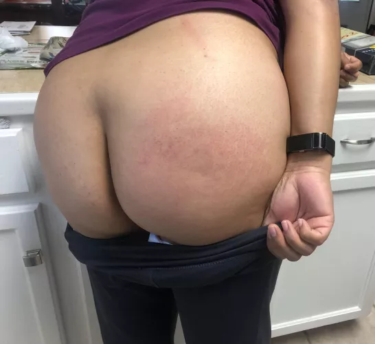 Got spanked for ruining dinner 