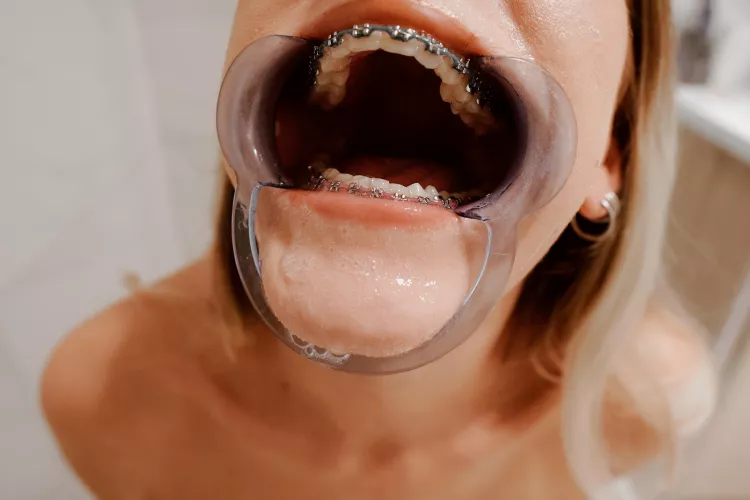 Just a big open hole