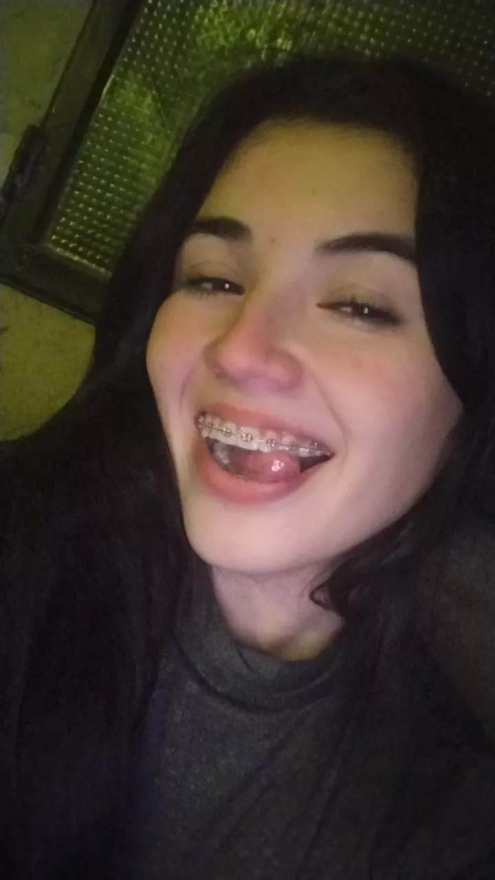 Last month without my braces. Will I get used to it?