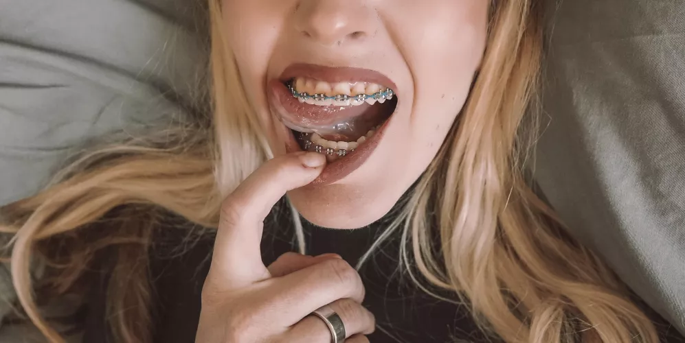 Oops, got a lil’ something stuck in my teeth. Can you get it for me?