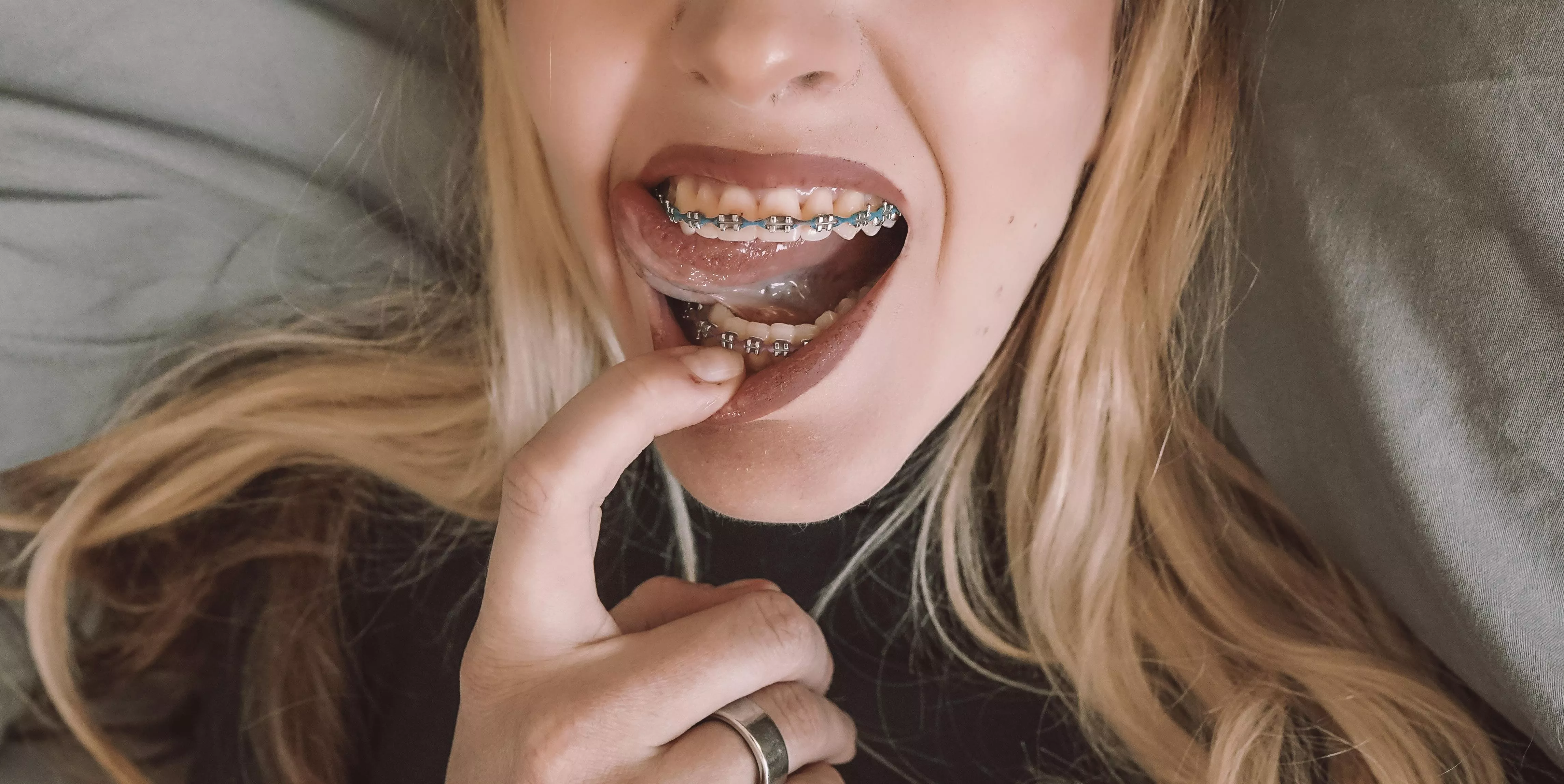 Oops, got a lil’ something stuck in my teeth. Can you get it for me?