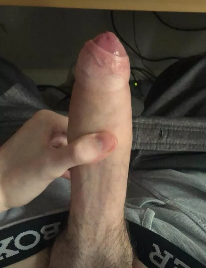 insecure about my foreskin, anyone like this? (D M ME)