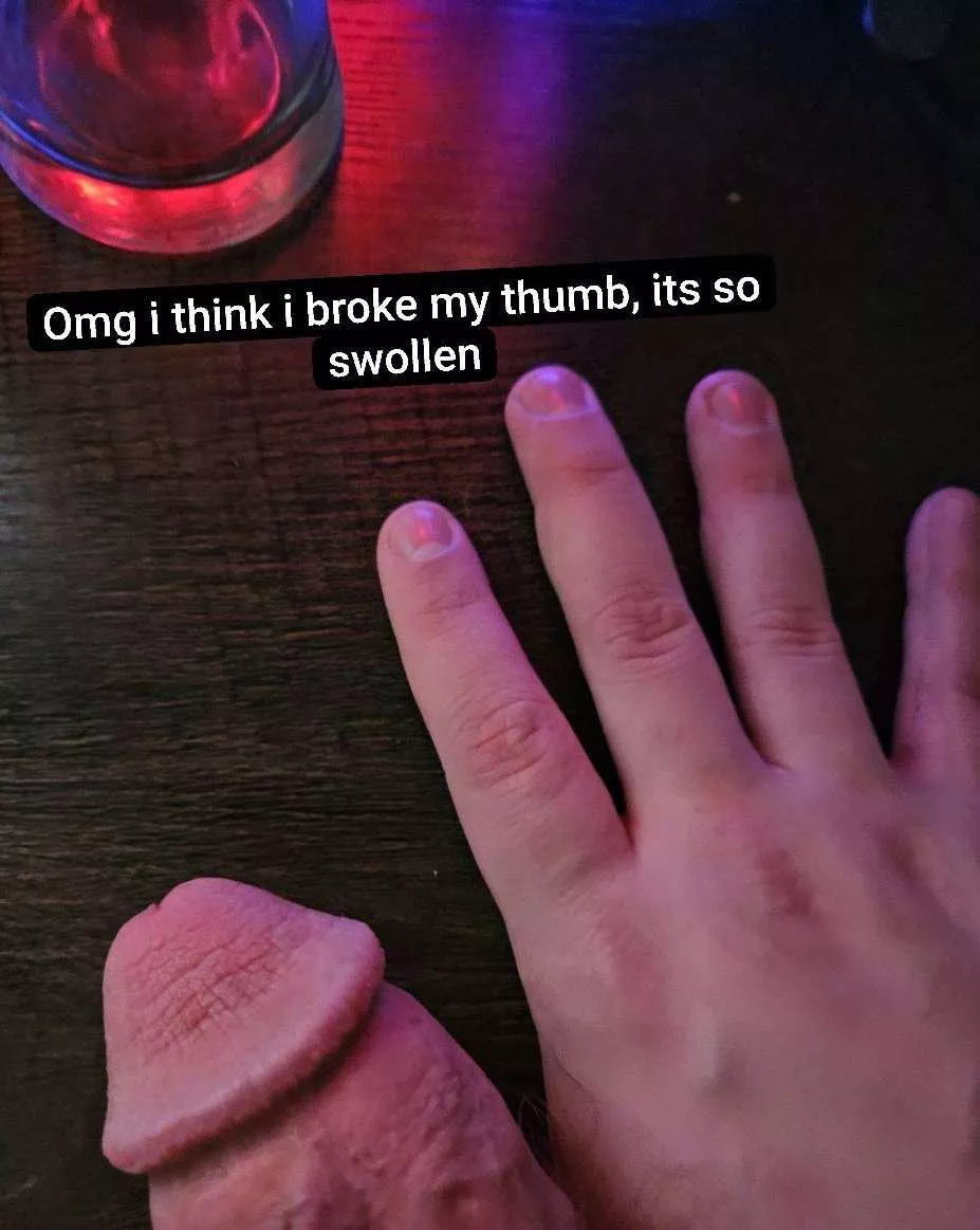 Let's wish him a quick recovery!