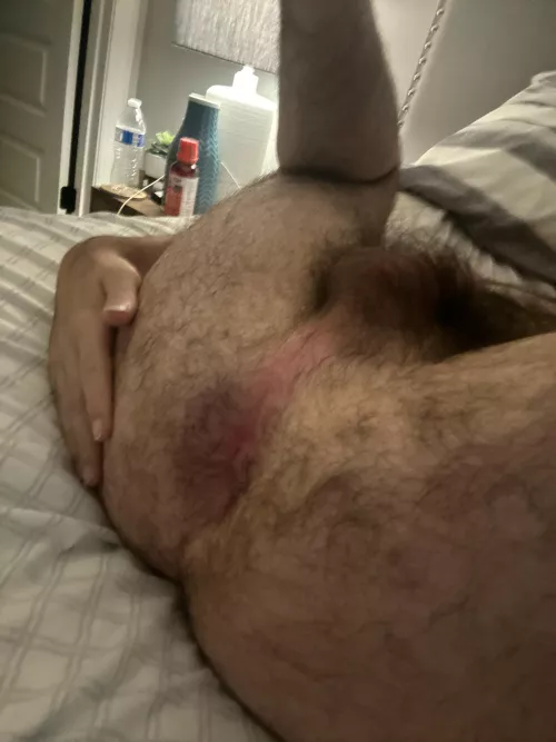 My hole needs to be spread 