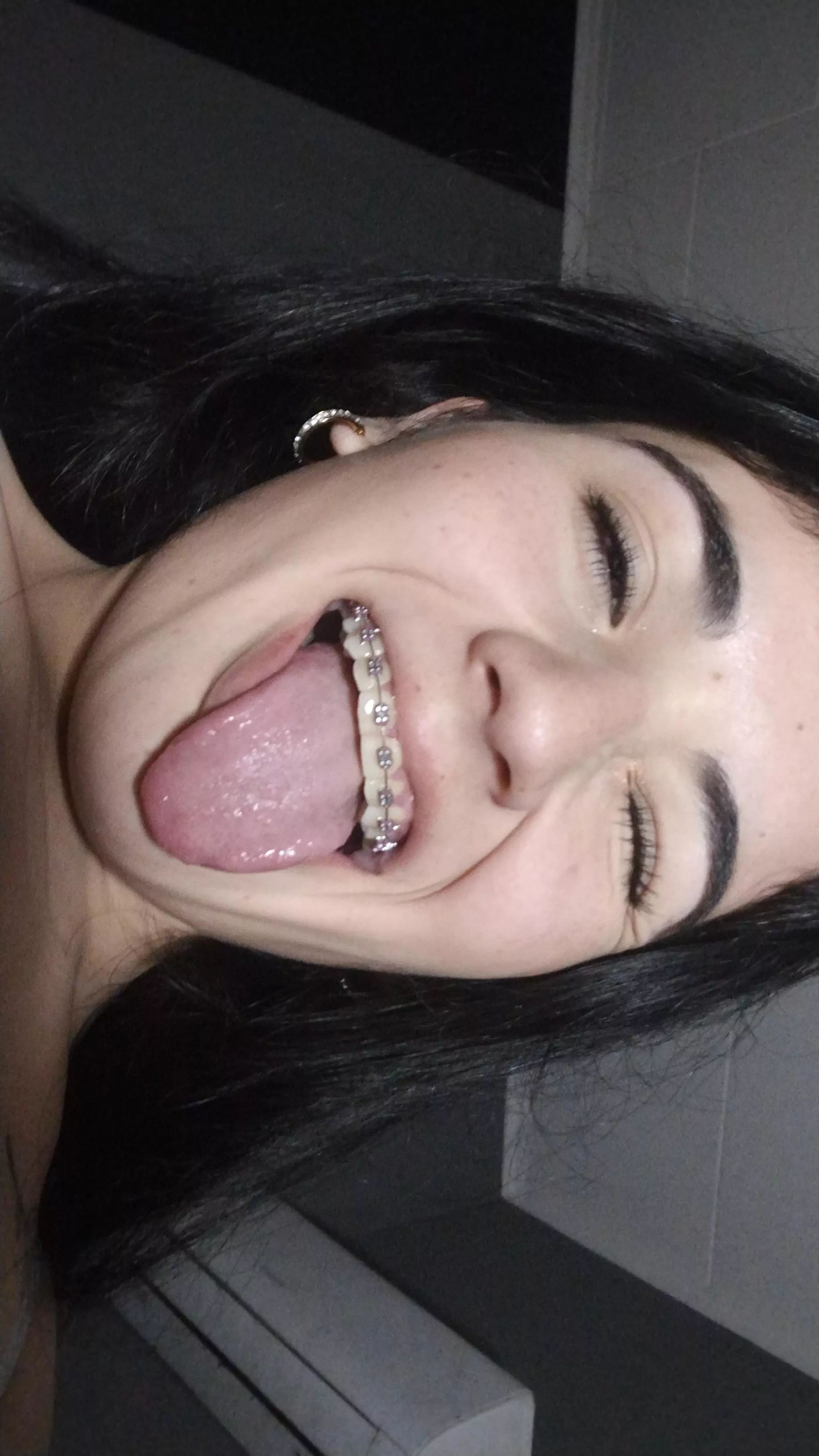 my tongue and my braces look sexy