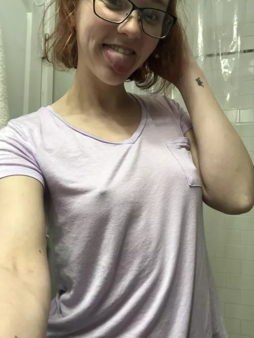 Freckles are sexy😛