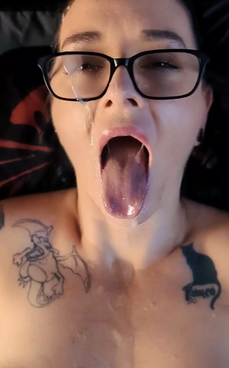 In, on and around my mouth