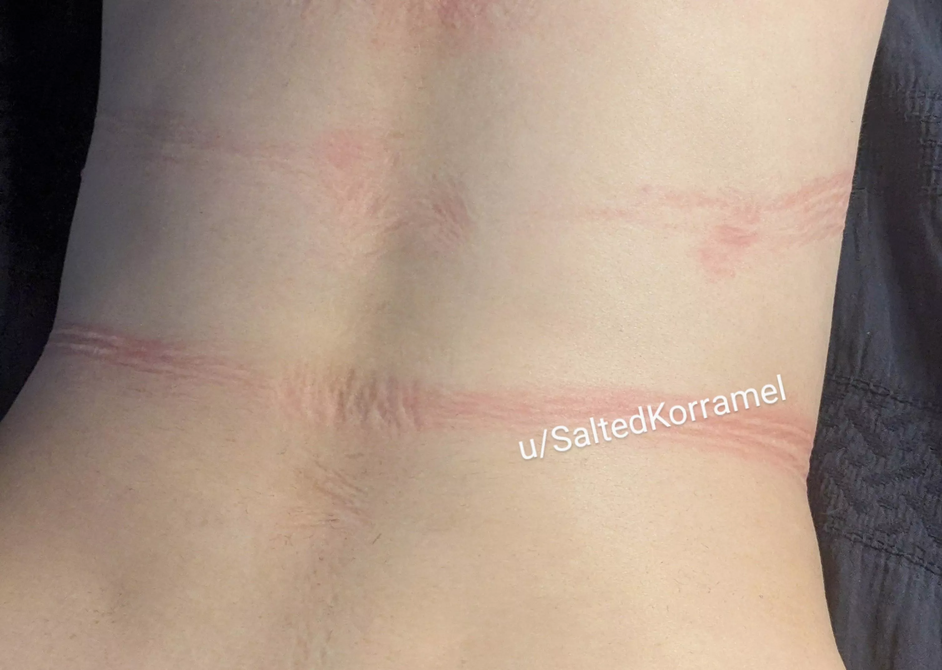 These ropes got my back good