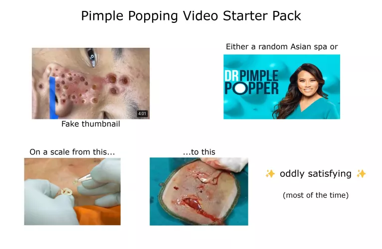 This isn't a pop, sadly, but spend enough time searching for pimple popping videos on YouTube and you notice some trends. 