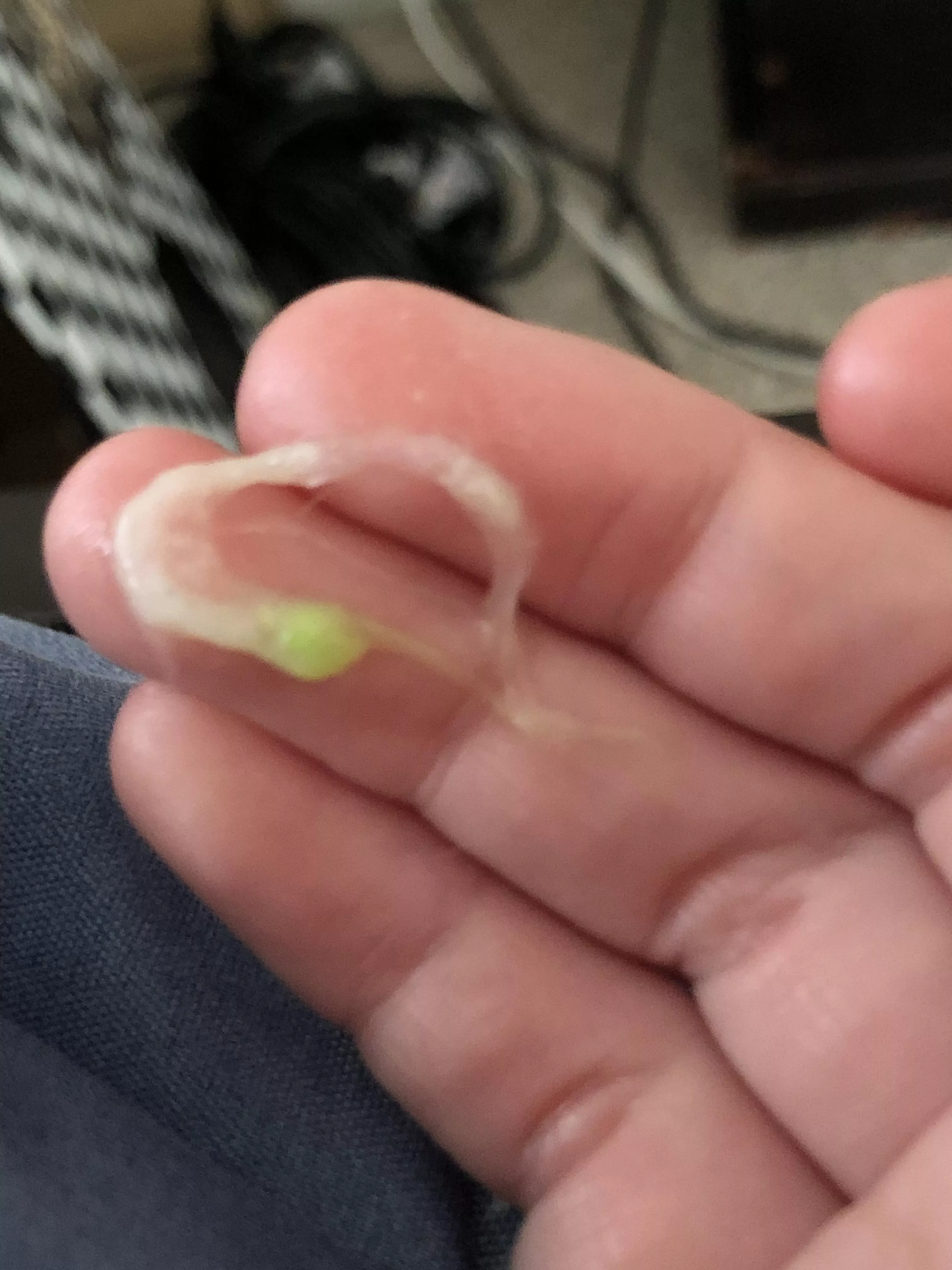 Bright green phlegm I coughed up