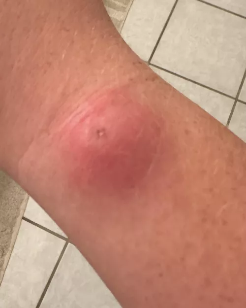 I wish this would pop so bad