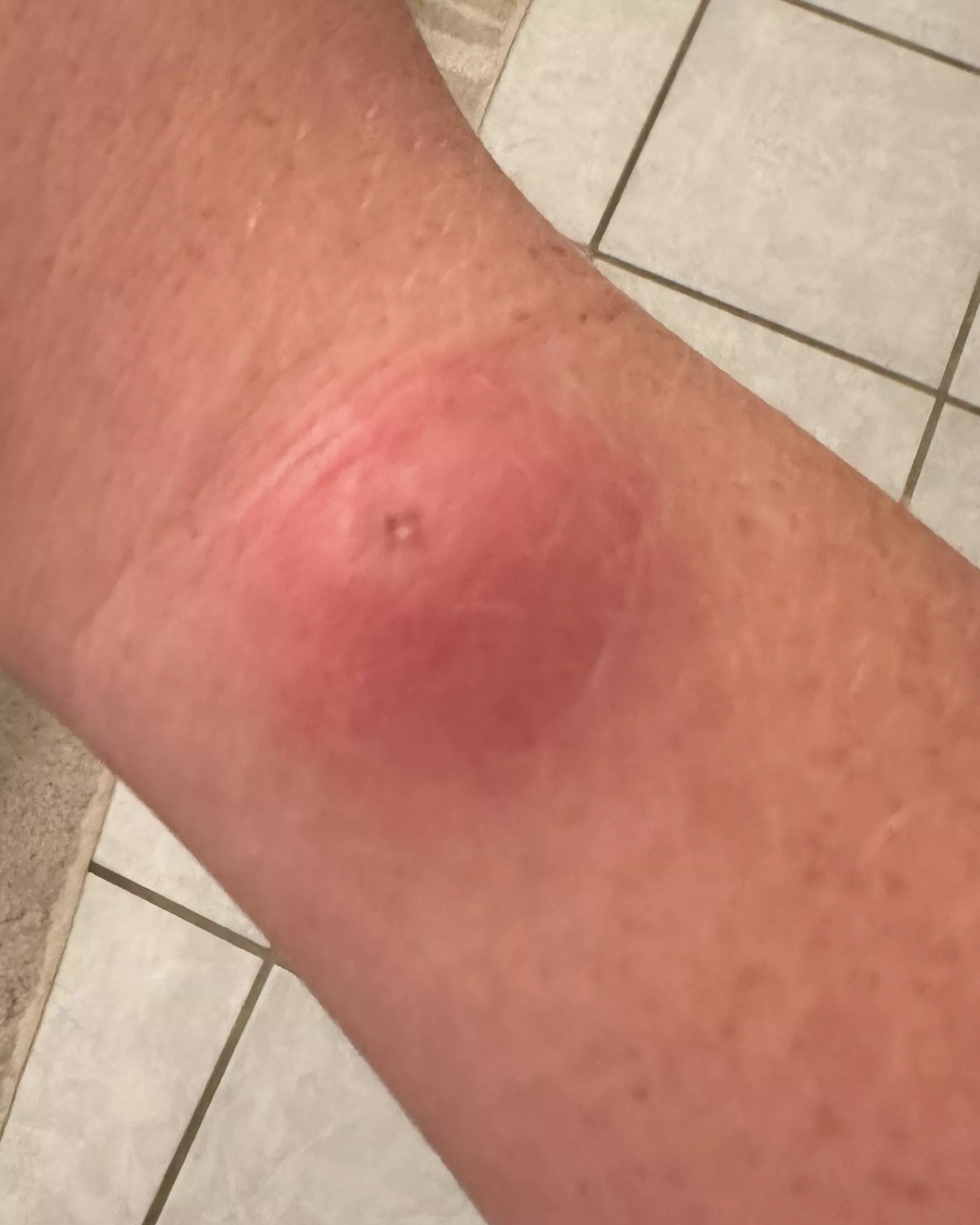 I wish this would pop so bad