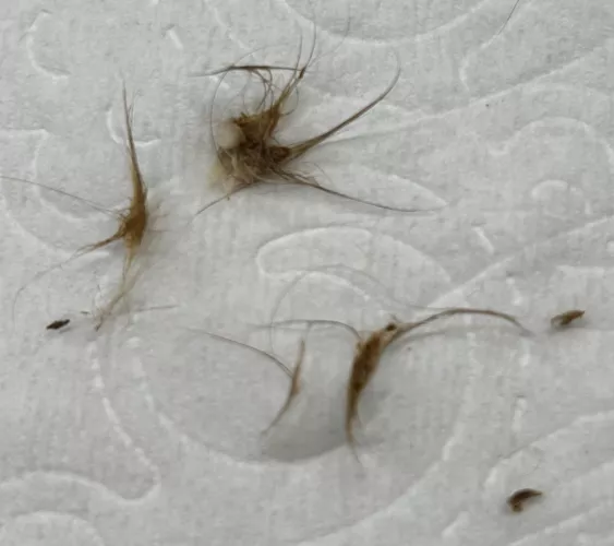 Results of cleaning out my belly button