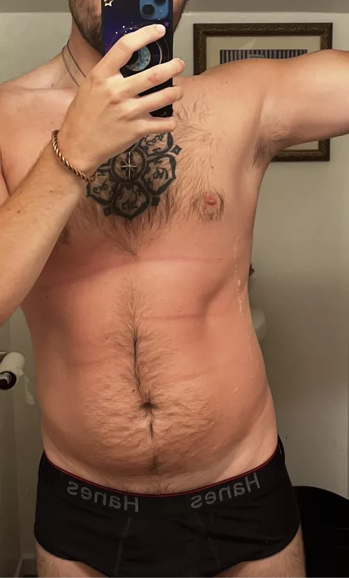 So I got a big burnt last week, ignore the peeling. 