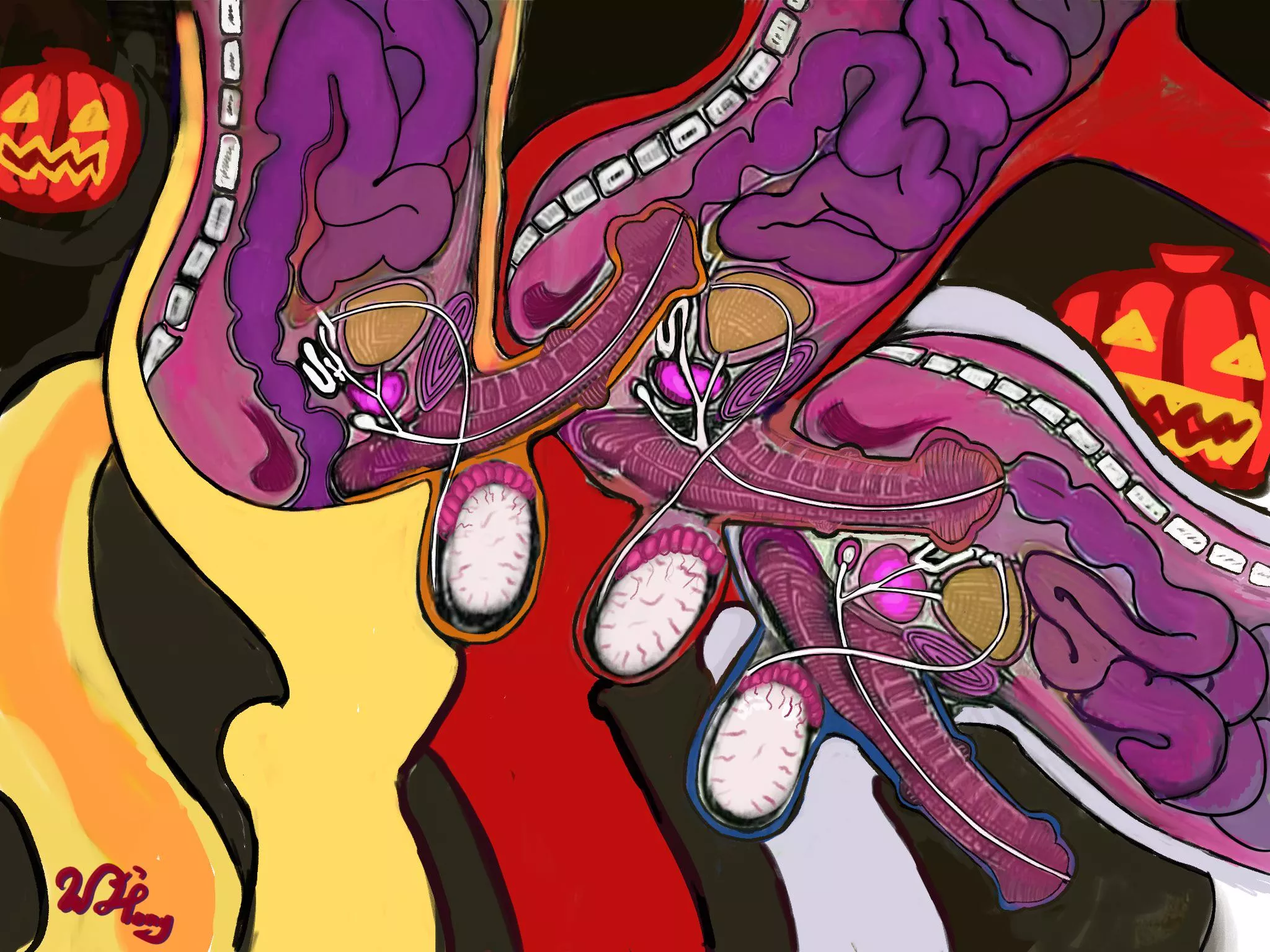 Gay lovetrain X-Ray (artist:ponycor)