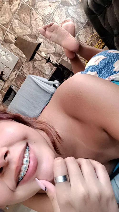 I'm a little comfortable and I like to smile with my braces in front of the camera 