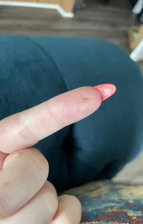 This little pearl popped out of my head today. I dropped it before I could examine further :(