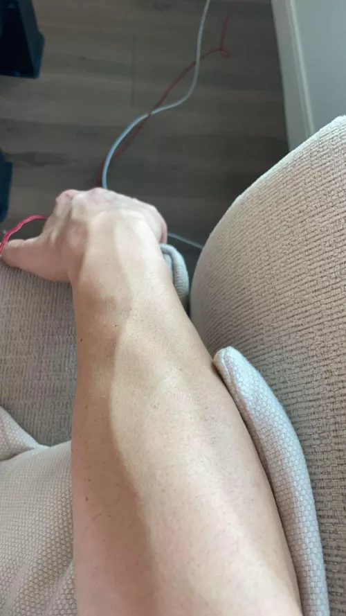 Veins or wires